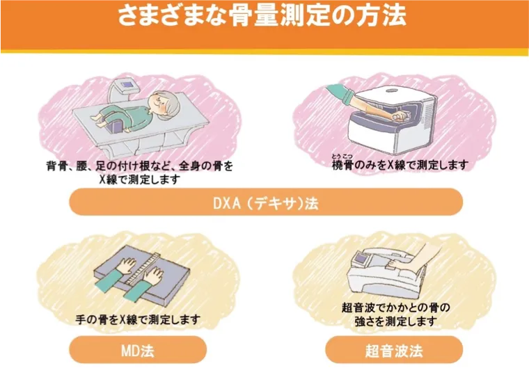 骨密度検査の写真