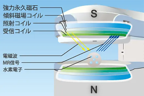 オープンMRI