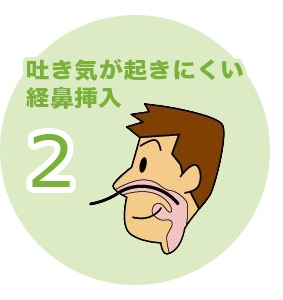 吐き気が起きにくい経鼻挿入